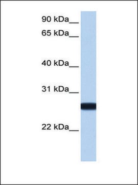Anti-IL13RA2 (AB1) antibody produced in rabbit affinity isolated antibody