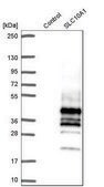 Anti-SLC10A1 antibody produced in rabbit Prestige Antibodies® Powered by Atlas Antibodies, affinity isolated antibody, buffered aqueous glycerol solution