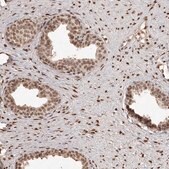 抗-ZNF503 兔抗 Prestige Antibodies&#174; Powered by Atlas Antibodies, affinity isolated antibody, buffered aqueous glycerol solution