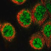 Anti-C16orf70 antibody produced in rabbit Prestige Antibodies® Powered by Atlas Antibodies, affinity isolated antibody, buffered aqueous glycerol solution