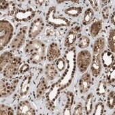 Anti-TLK1 antibody produced in rabbit Prestige Antibodies&#174; Powered by Atlas Antibodies, affinity isolated antibody, buffered aqueous glycerol solution