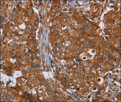 Anti-PLEC antibody produced in rabbit affinity isolated antibody