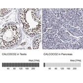 Anti-CALCOCO2 antibody produced in rabbit Prestige Antibodies® Powered by Atlas Antibodies, affinity isolated antibody, buffered aqueous glycerol solution, Ab1