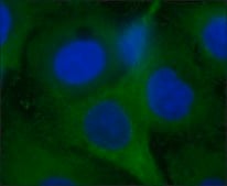 Anti-Nitrotyrosine antibody produced in rabbit affinity isolated antibody, buffered aqueous solution