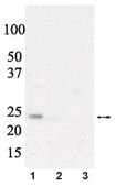 Anti-phospho eIF4E (Ser209) Antibody Upstate®, from rabbit