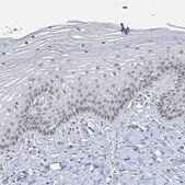 Anti-KMT2D antibody produced in rabbit Prestige Antibodies&#174; Powered by Atlas Antibodies, affinity isolated antibody, buffered aqueous glycerol solution