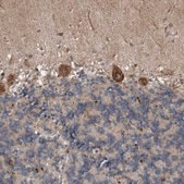 Anti-EXOC8 antibody produced in rabbit Prestige Antibodies&#174; Powered by Atlas Antibodies, affinity isolated antibody, buffered aqueous glycerol solution