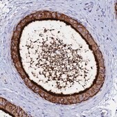 Anti-BASP1 antibody produced in rabbit Prestige Antibodies&#174; Powered by Atlas Antibodies, affinity isolated antibody, buffered aqueous glycerol solution