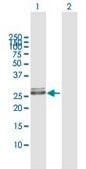 Anti-HLA-DRB1 antibody produced in mouse purified immunoglobulin, buffered aqueous solution