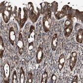 Anti-GALNT8 antibody produced in rabbit Prestige Antibodies&#174; Powered by Atlas Antibodies, affinity isolated antibody, buffered aqueous glycerol solution