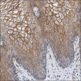 Anti-DSG1 antibody produced in rabbit Prestige Antibodies® Powered by Atlas Antibodies, affinity isolated antibody, buffered aqueous glycerol solution