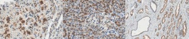 Anti-ARHGAP36 Antibody, clone 12D10.1 clone 12D10.1, from mouse