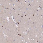 Anti-AP3B2 antibody produced in rabbit Prestige Antibodies&#174; Powered by Atlas Antibodies, affinity isolated antibody, buffered aqueous glycerol solution