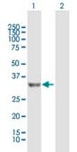 Anti-PROSC antibody produced in mouse IgG fraction of antiserum, buffered aqueous solution