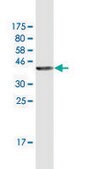Monoclonal Anti-STX11 antibody produced in mouse clone 4F9, purified immunoglobulin, buffered aqueous solution