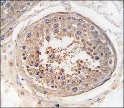 Anti-SPAG9 (center) antibody produced in rabbit saturated ammonium sulfate (SAS) precipitated, buffered aqueous solution