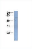 Anti-SLC22A11 (AB1) antibody produced in rabbit affinity isolated antibody