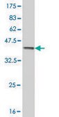Monoclonal Anti-AKR1C2 antibody produced in mouse clone 3C11, purified immunoglobulin, buffered aqueous solution