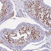 Anti-AC004381.6 antibody produced in rabbit Prestige Antibodies&#174; Powered by Atlas Antibodies, affinity isolated antibody, buffered aqueous glycerol solution