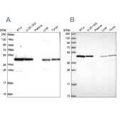 Anti-NSFL1C antibody produced in rabbit Prestige Antibodies&#174; Powered by Atlas Antibodies, affinity isolated antibody, buffered aqueous glycerol solution