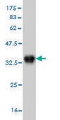 Monoclonal Anti-AURKB, (N-terminal) antibody produced in mouse clone 6G8, purified immunoglobulin, buffered aqueous solution