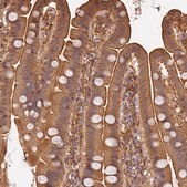 Anti-ARHGAP17 antibody produced in rabbit Prestige Antibodies&#174; Powered by Atlas Antibodies, affinity isolated antibody, buffered aqueous glycerol solution