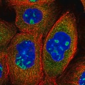 Anti-ANKRD18A antibody produced in rabbit Prestige Antibodies&#174; Powered by Atlas Antibodies, affinity isolated antibody, buffered aqueous glycerol solution