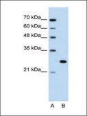 Anti-FOXR2 antibody produced in rabbit IgG fraction of antiserum