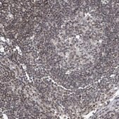 Anti-TAF8 antibody produced in rabbit Prestige Antibodies&#174; Powered by Atlas Antibodies, affinity isolated antibody, buffered aqueous glycerol solution