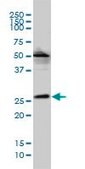 Monoclonal Anti-VPS25 antibody produced in mouse clone 2E5-2B9, purified immunoglobulin, buffered aqueous solution