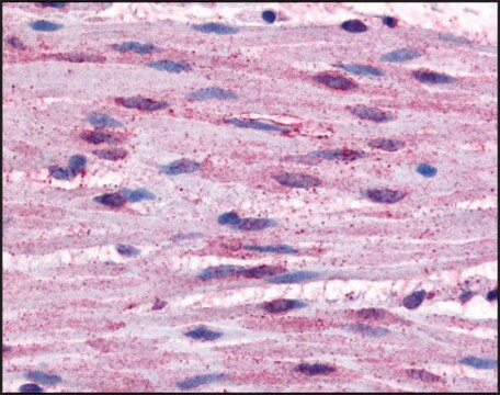 Anti-ADRA1B (AB1) antibody produced in rabbit affinity isolated antibody, buffered aqueous solution