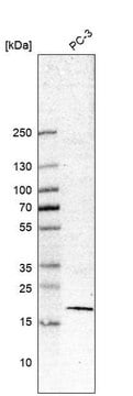 Anti-BIRC5 antibody produced in mouse Prestige Antibodies&#174; Powered by Atlas Antibodies, clone CL12064, purified by using Protein A, buffered aqueous glycerol solution