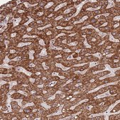 Anti-IVD antibody produced in rabbit Prestige Antibodies® Powered by Atlas Antibodies, affinity isolated antibody, buffered aqueous glycerol solution