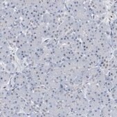 Anti-RPP30 antibody produced in rabbit Prestige Antibodies® Powered by Atlas Antibodies, affinity isolated antibody, buffered aqueous glycerol solution