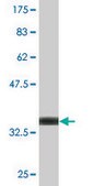 Monoclonal Anti-BLMH antibody produced in mouse clone 4A2, purified immunoglobulin, buffered aqueous solution