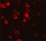 Anti-CXXC4 antibody produced in rabbit affinity isolated antibody, buffered aqueous solution