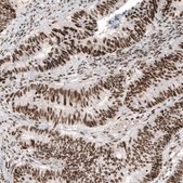 Monoclonal Anti-JUN antibody produced in mouse Prestige Antibodies® Powered by Atlas Antibodies, clone CL9662, purified immunoglobulin, buffered aqueous glycerol solution