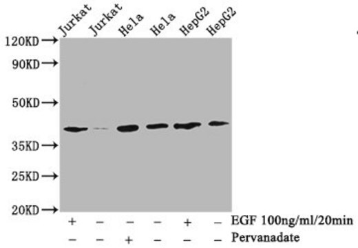Anti-phospho-LAT (Y191) antibody, clone 2E4, Rabbit Monoclonal recombinant, expressed in HEK293F cells