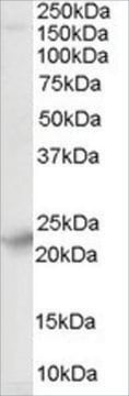 Anti-Synaptogyrin 4 antibody produced in goat affinity isolated antibody, buffered aqueous solution