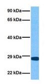 Anti-PLUNC antibody produced in rabbit affinity isolated antibody