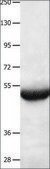 Anti-BPIFB3 antibody produced in rabbit affinity isolated antibody
