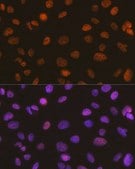 Anti-SMARCA5/SNF2H antibody produced in rabbit
