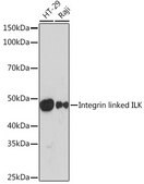 Anti-Integrin linked ILK Antibody, clone 5R10U3, Rabbit Monoclonal