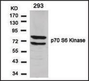 Anti-RPS6KB1 (Ab-424) antibody produced in rabbit affinity isolated antibody