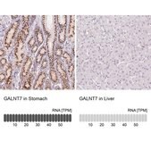 Anti-GALNT7 antibody produced in rabbit Prestige Antibodies® Powered by Atlas Antibodies, affinity isolated antibody, buffered aqueous glycerol solution