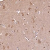 Anti-PLCB1 antibody produced in rabbit Prestige Antibodies&#174; Powered by Atlas Antibodies, affinity isolated antibody, buffered aqueous glycerol solution