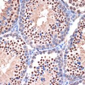 Anti-NUP153 antibody produced in rabbit
