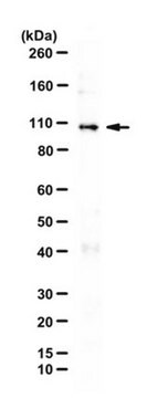 Anti-Transportin-3 Antibody from rabbit, purified by affinity chromatography