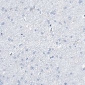Anti-VAMP8 antibody produced in rabbit Prestige Antibodies&#174; Powered by Atlas Antibodies, affinity isolated antibody, buffered aqueous glycerol solution