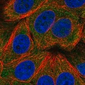 Anti-TIGAR antibody produced in rabbit Prestige Antibodies&#174; Powered by Atlas Antibodies, affinity isolated antibody, buffered aqueous glycerol solution